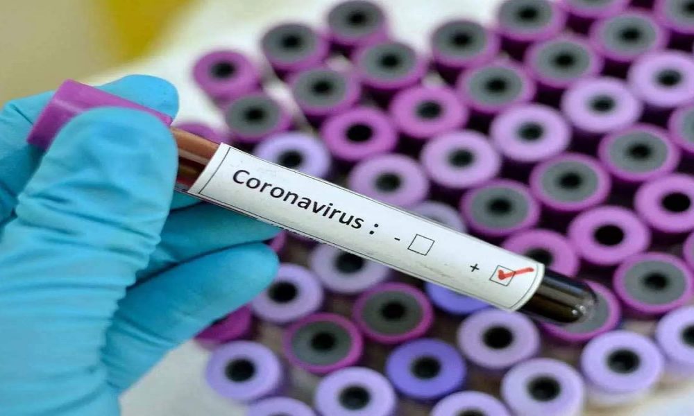 CSIR begins drug trial for vaccine against Covid-19