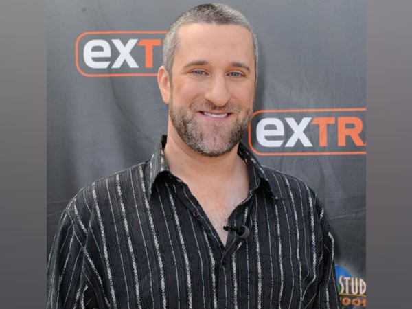 Dustin Diamond passes away at 44