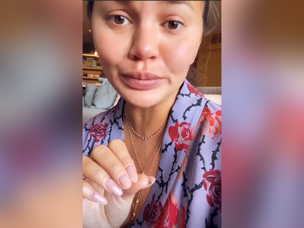 Chrissy Teigen pays tribute to baby Jack