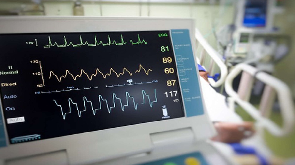 MILD COVID-19 INFECTION IS VERY UNLIKELY TO CAUSE LASTING HEART DAMAGE