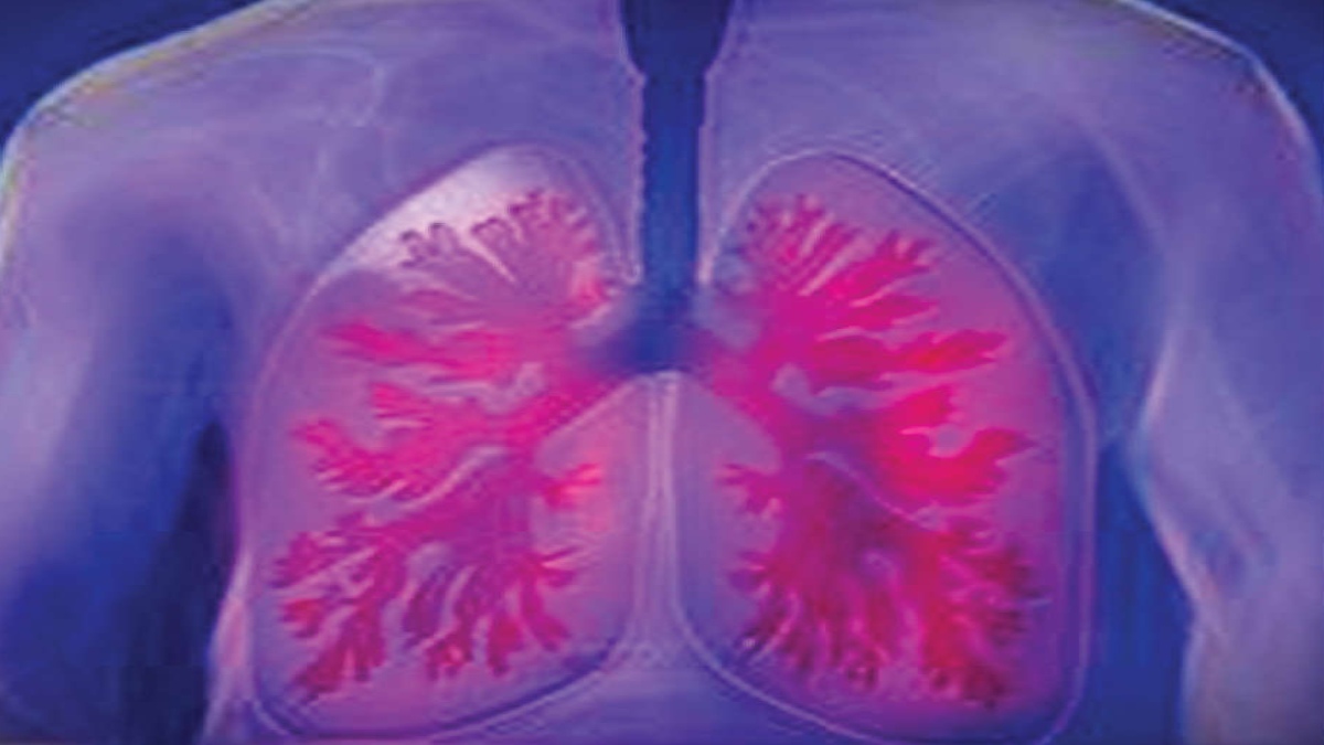 Radiotracer effective for detection and assessment of lung fibrosis