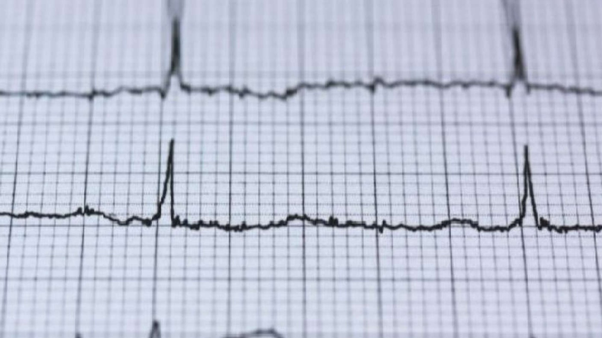 STROKE MIGHT BE INITIAL SIGN OF CARDIOVASCULAR DISEASE AMONG SMOKERS