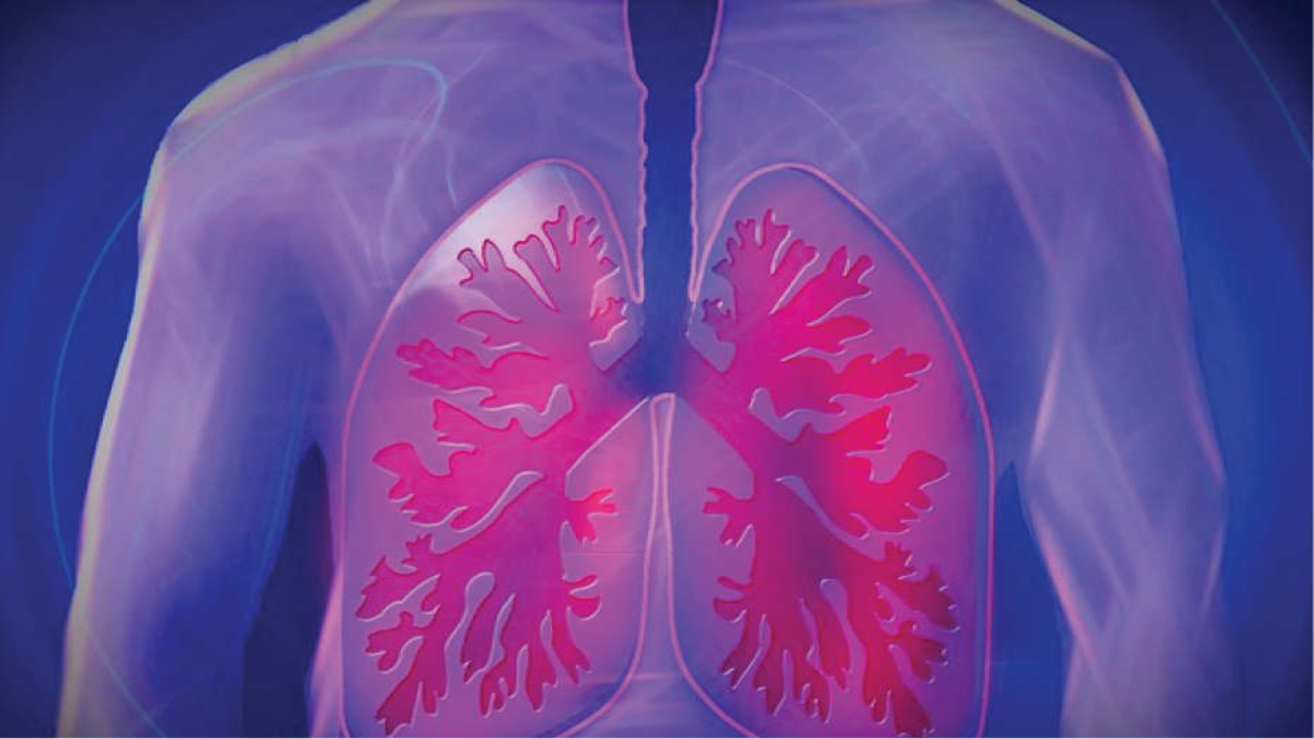 Study for better understanding of cystic fibrosis