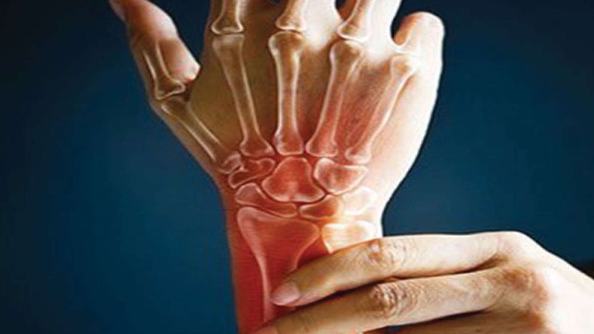 WHY IS RHEUMATOID ARTHRITIS MORE COMMON IN WOMEN?