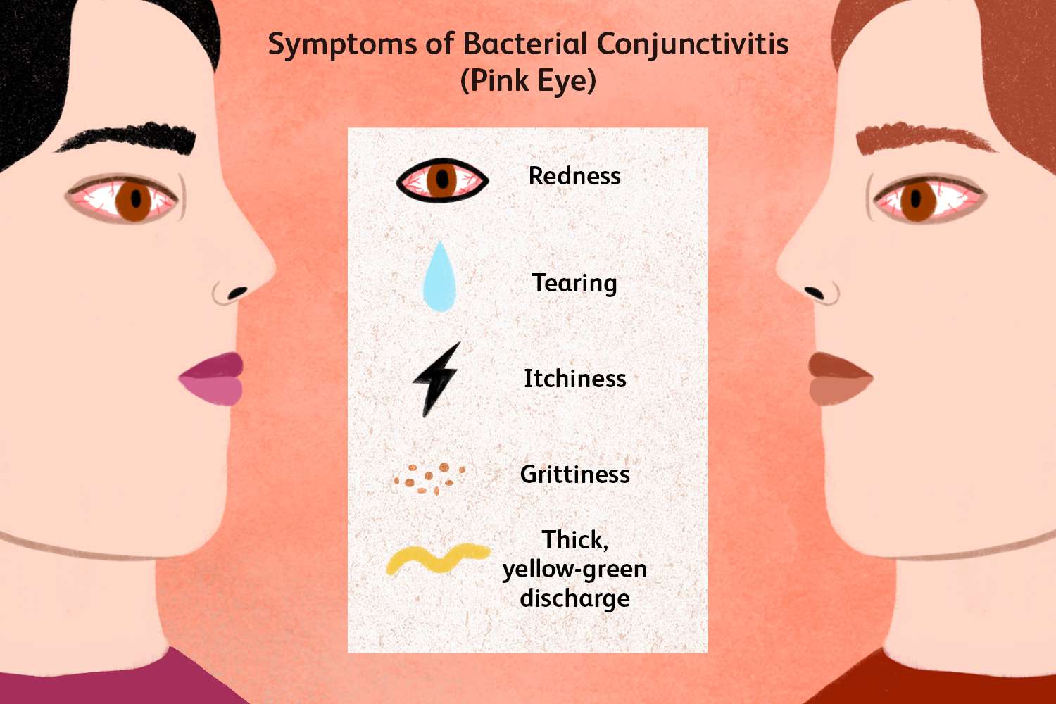 Conjunctivitis on the rise: Top foods for eye health