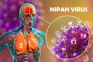 Nipah virus: In Kerala one more case confirmed ; Total tally 6, active cases now 4