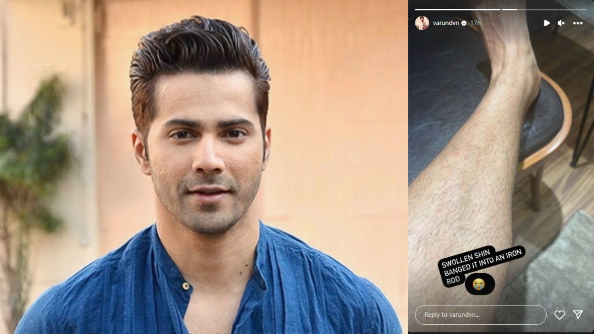 Varun Dhawan injures his leg while shooting for upcoming project, ‘VD 18’