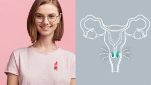 Cervical cancer in young women: Rising trends & challenges