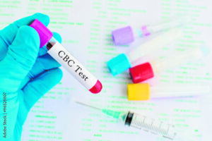 Prioritizing Prevention: The Top 5 Blood Tests You Should Include in Your Annual Health Checkup