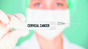 Understanding cervical cancer: Addressing patient concerns