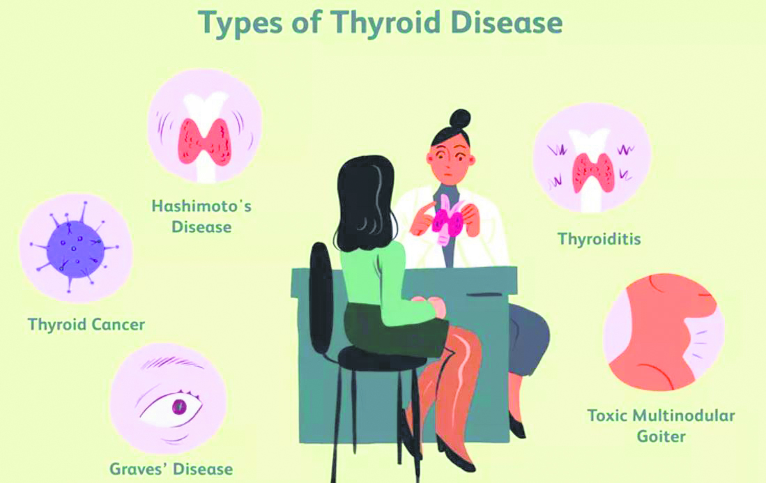 Unmasking the Silent Threat 200 Million people are affected globally with Thyroid Disorders