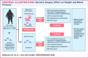 Bariatric Surgery outperforms meds in obesity-linked hypertension