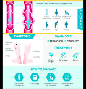 Understanding Varicose Veins: Causes, Symptoms, and Complications