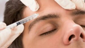 Exploring Botox as a Remedy for Migraine