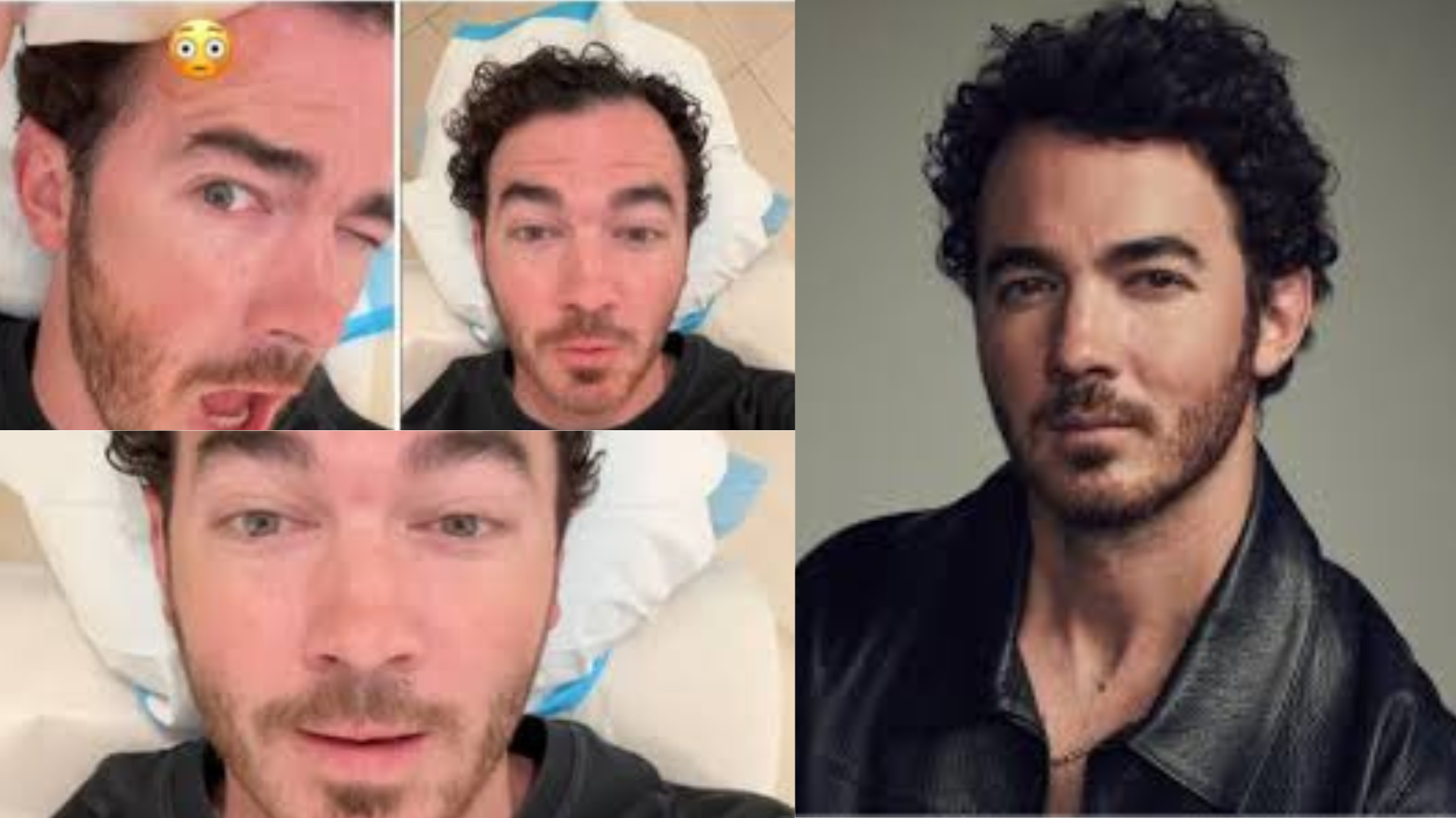 Kevin Jonas Urges Fans To Prioritize Health After Undergoing Skin Cancer Surgery: Learn About Skin Cancer Types