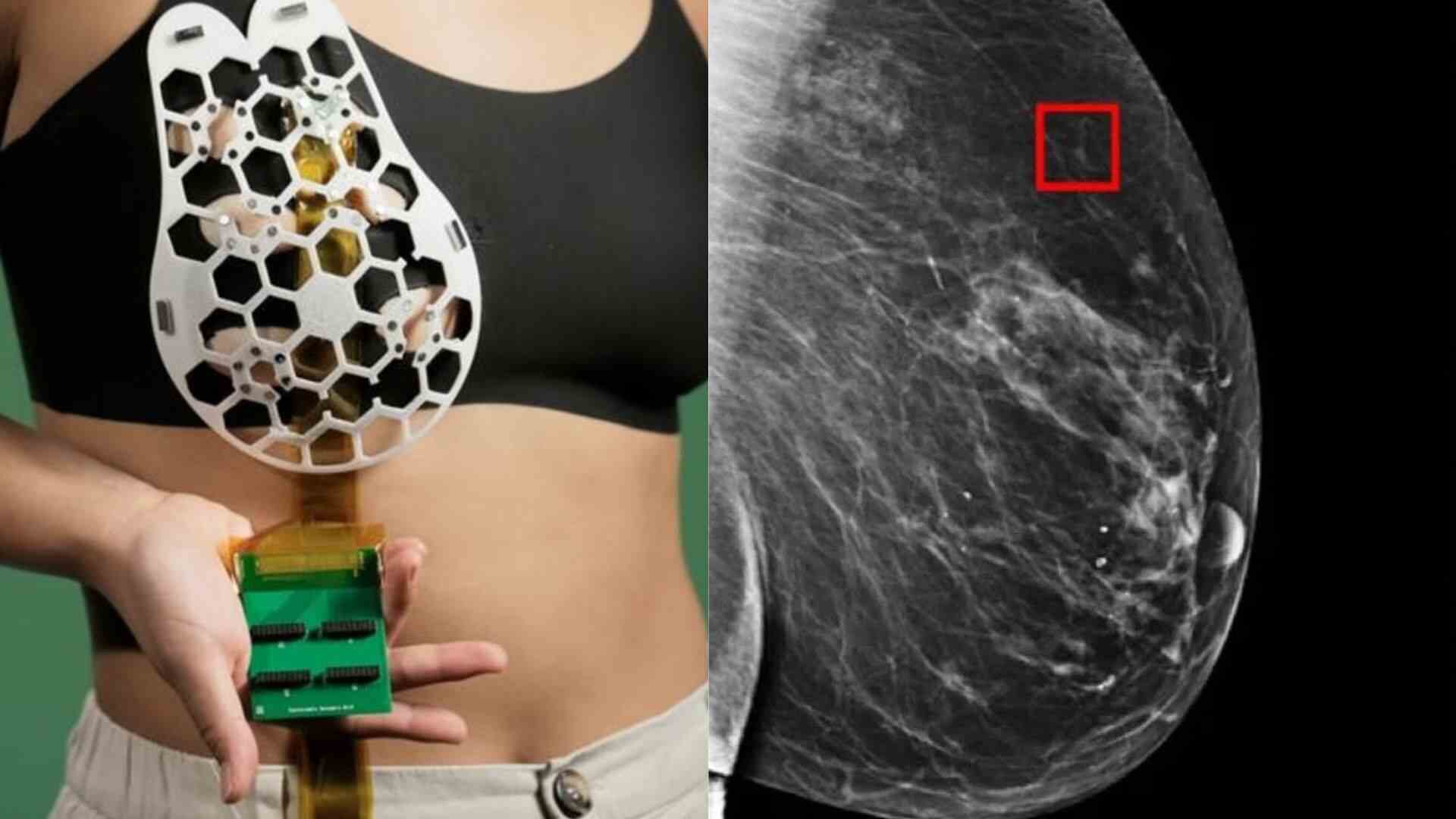 AI Model Predicts Breast Cancer Risk Years Ahead: Anand Mahindra’s Tweet Goes Viral