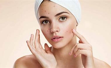 Top 10 Steps to Get Pimple-Free Skin Within Days