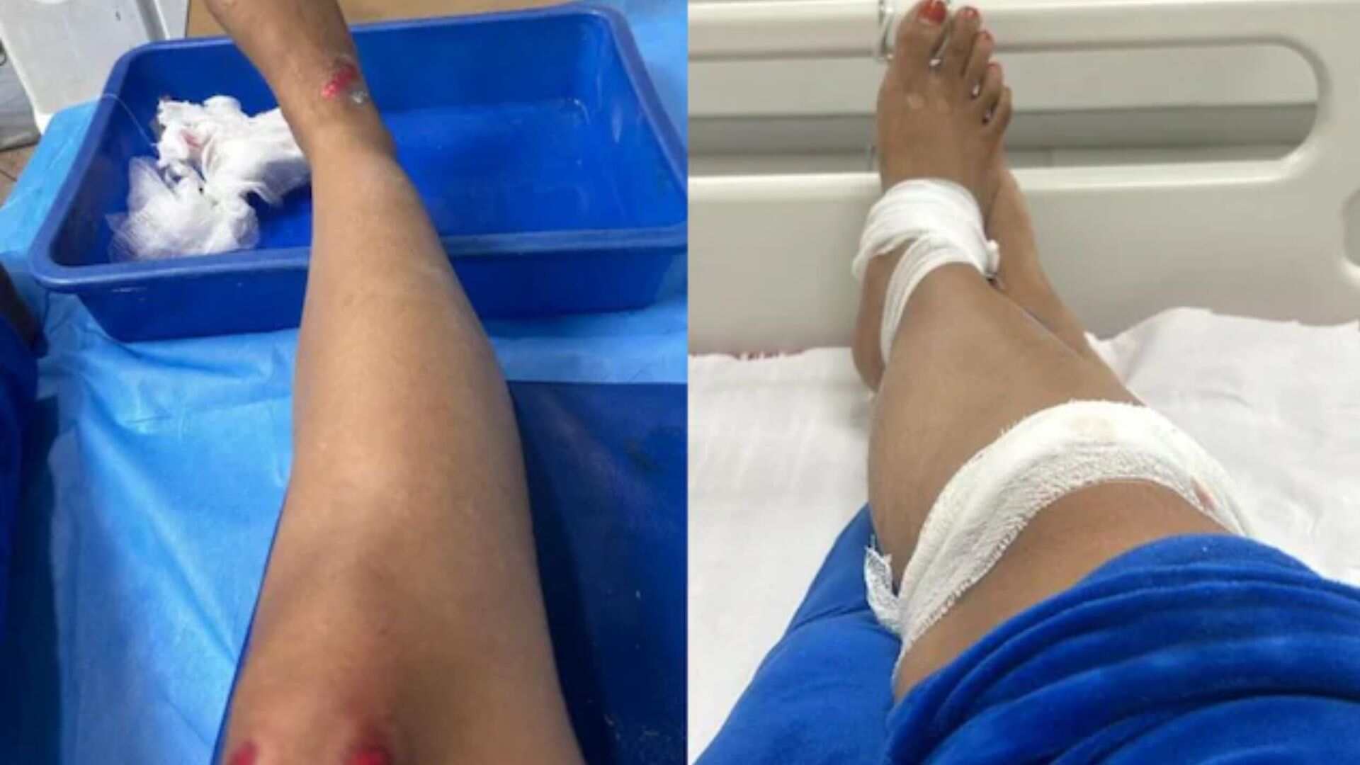 Woman Gets Injured Due to Bike Rider's Reckless Driving