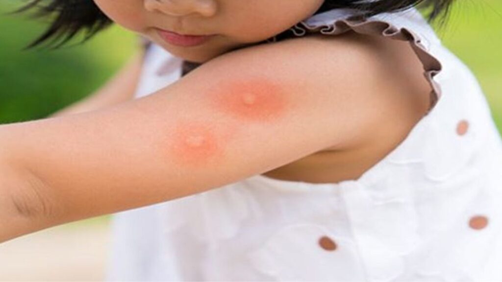 mosquito borne diseases