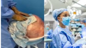 Kazakhstan Surgeons Extract 30kg Tumor From Woman’s Stomach