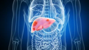 Maintain a Healthy Liver: Key to a Fit and Active Life