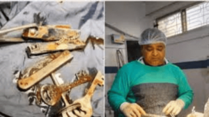 Key Ring, Knife, Nail Cutters Removed From Bihar Man’s Stomach Goes Viral