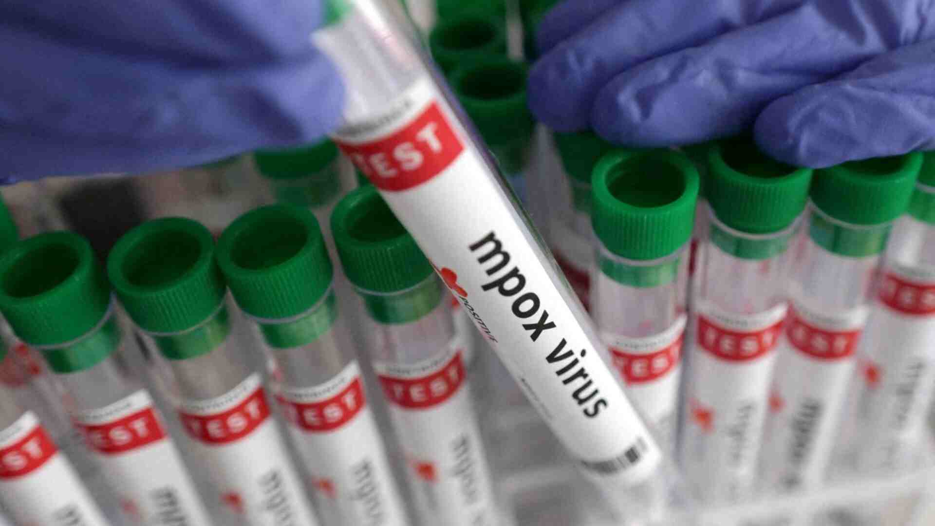 Mpox Outbreak In US Prison Turns Deadly, Spreads Among Inmates