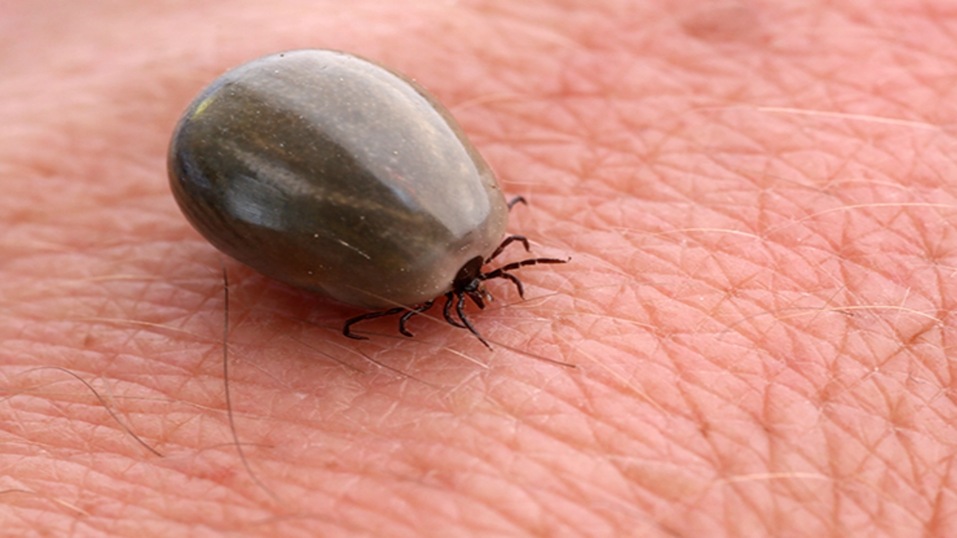 China Discovers New Tick-Borne Virus: Wetland Virus May Impact Brain Health