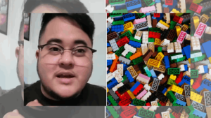 Man Finds Lego In His Nose After 26 Years Goes Viral: Watch