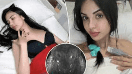 Brazilian Influencer $1 Million Butt Lift Fillers To Look Like Kim Kardashian Makes Her Infertile