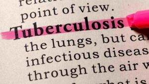 Tuberculosis Overtakes COVID-19 As The Deadliest Infectious Disease: WHO Reports