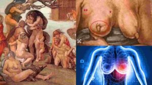 Michaelangelo’s Iconic 16th Century Artwork ‘Genesis’ Linked to Modern-Day Deadly Disease