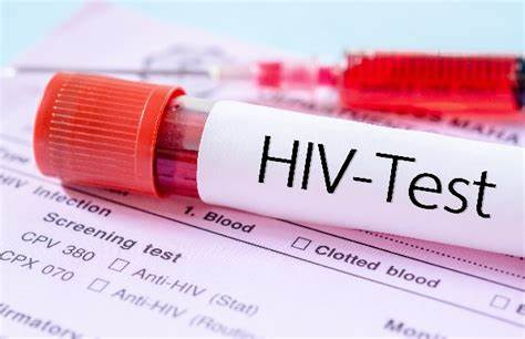 “Twice-Yearly HIV Shot: A Breakthrough in the Fight Against AIDS – But Can It Reach Those Who Need It Most?”