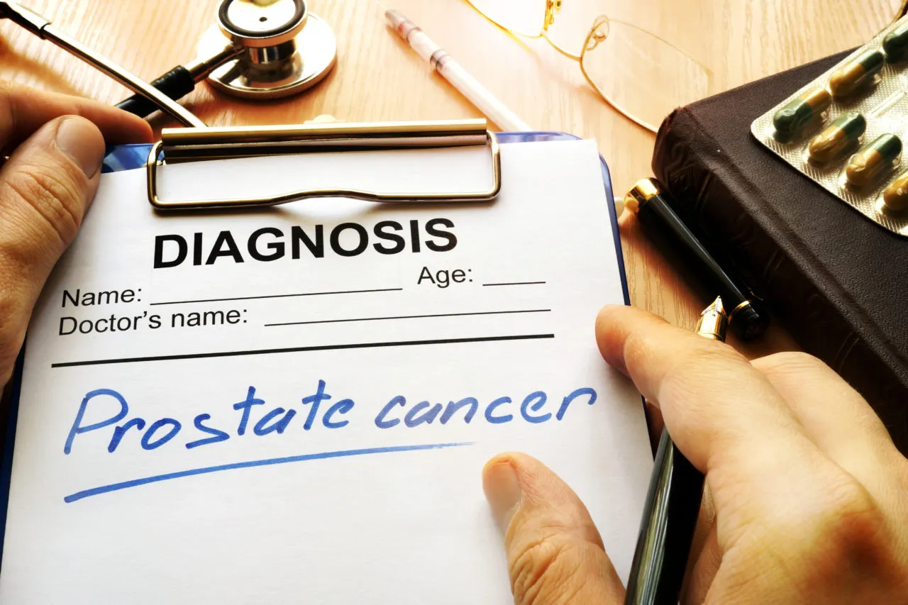 Prostate Cancer Surpasses Breast Cancer as UK’s Most Diagnosed Cancer