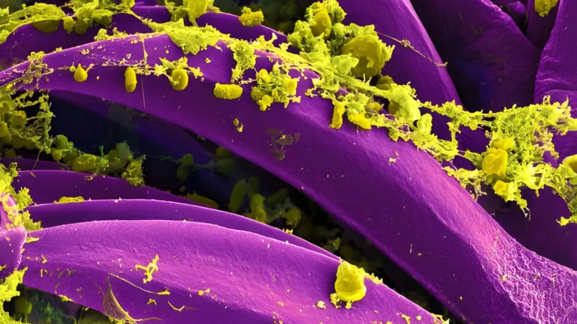 Arizona Reports Death from Plague: Key Facts and Safety Tips