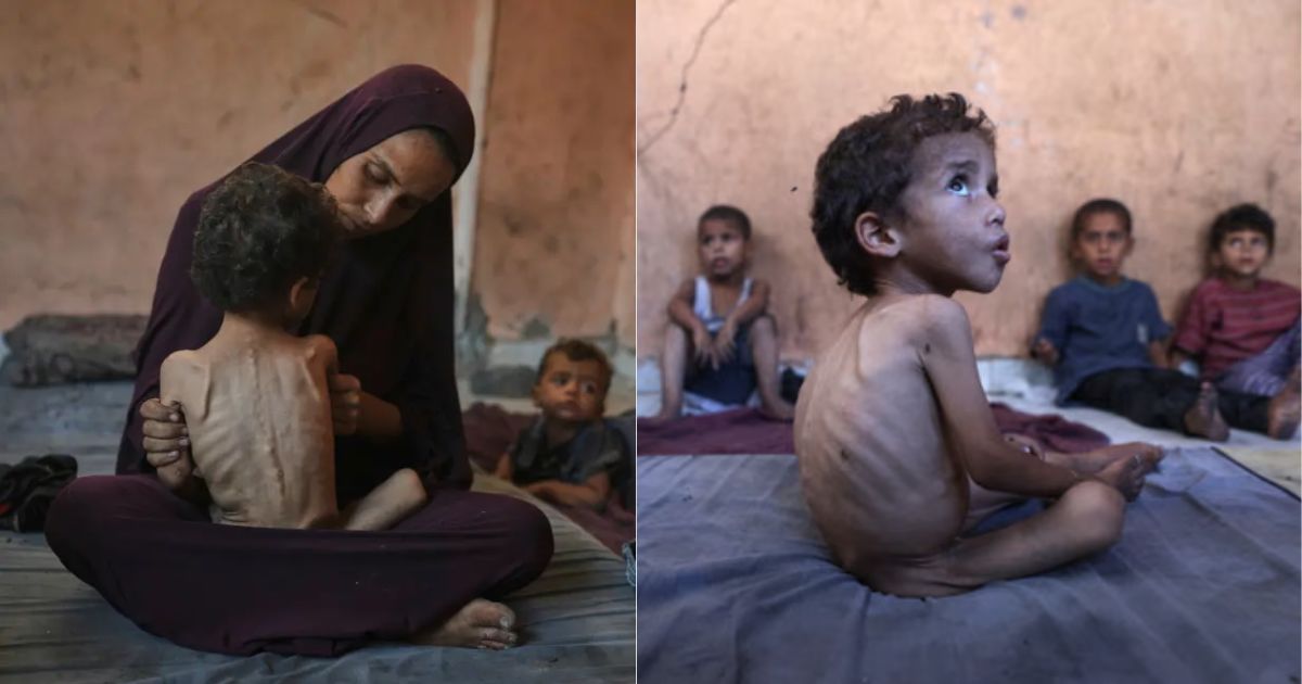 ‘Doctors Now Starve Too’: Gaza’s Health System Collapses in War’s Most Inhuman Phase