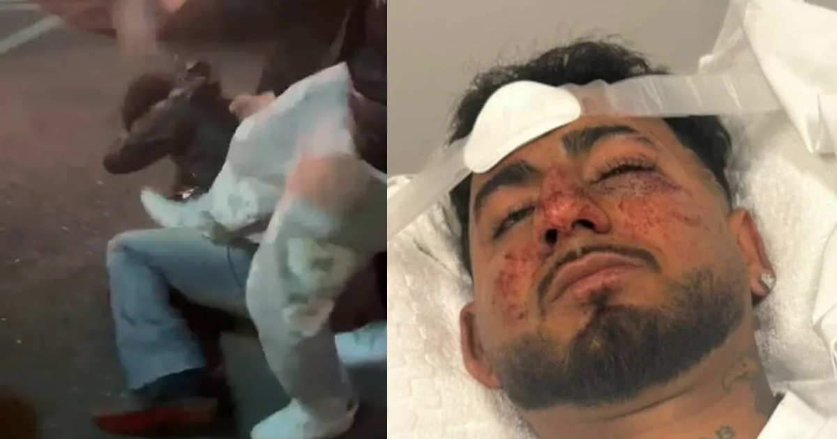“F**K Off, Indian”: Racial Attack in Adelaide Leaves Indian Student Severely Injured