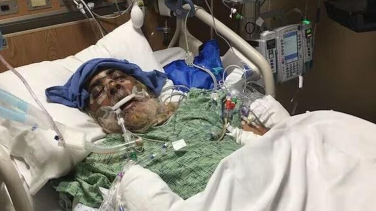 70-Year-Old Sikh Man Critical After Brutal Golf Club Attack in North Hollywood