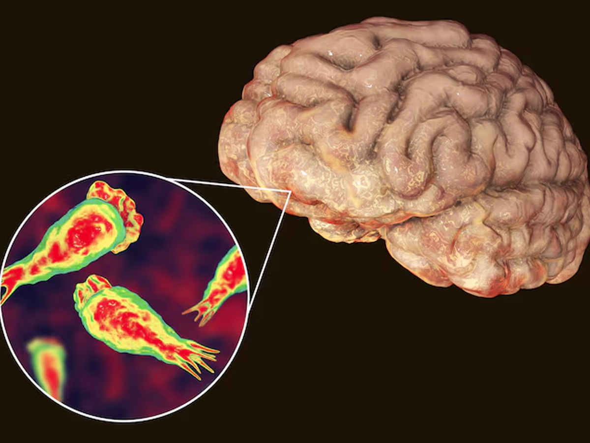 ‘Brain-Eating Amoeba’ Death in Kerala Sparks Health Alert — Are You Safe?