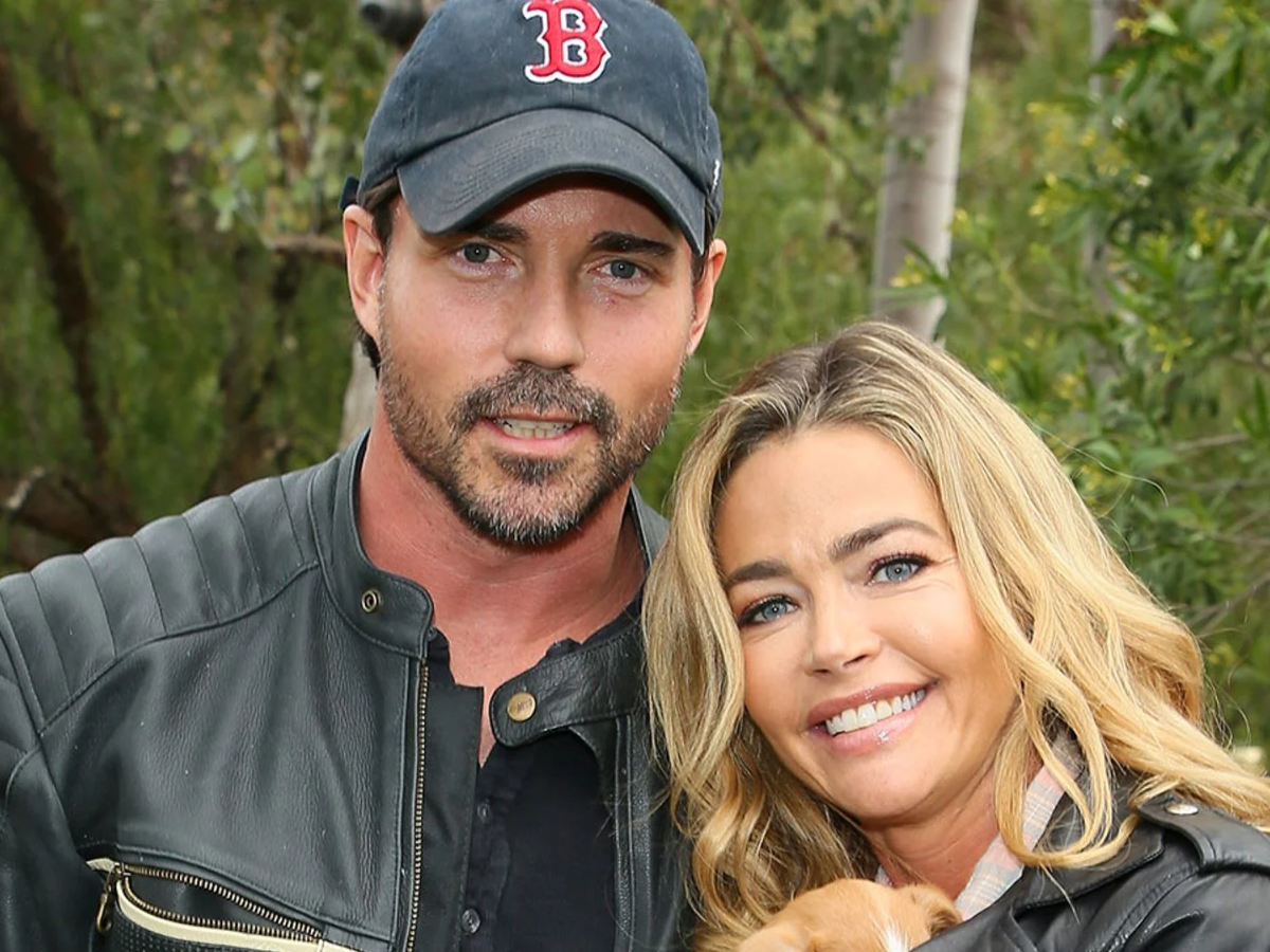 Denise Richards Appears with Black Eye Amid Turbulent Breakup with Aaron Phypers
