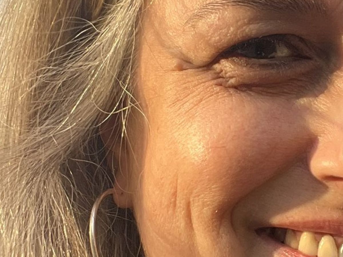 Stress causes premature ageing of the skin - Photo Gallery