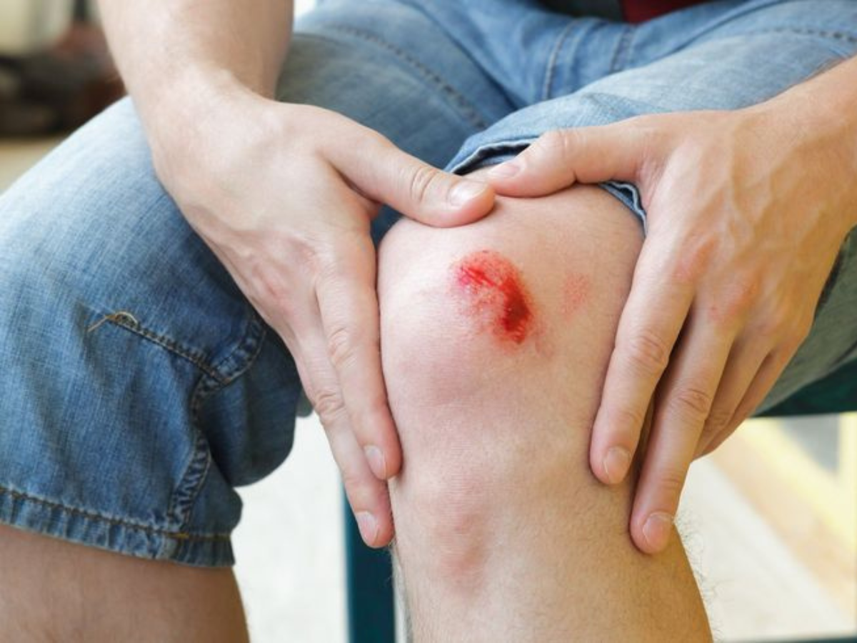 Poor wound healing may point to Vitamin C deficiency. - Photo Gallery