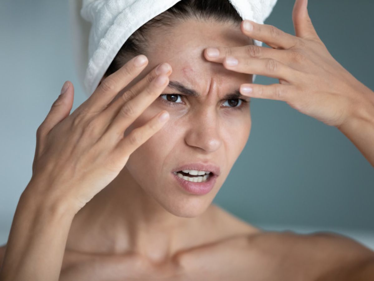 How Stress Shows on Your Face and Skin?