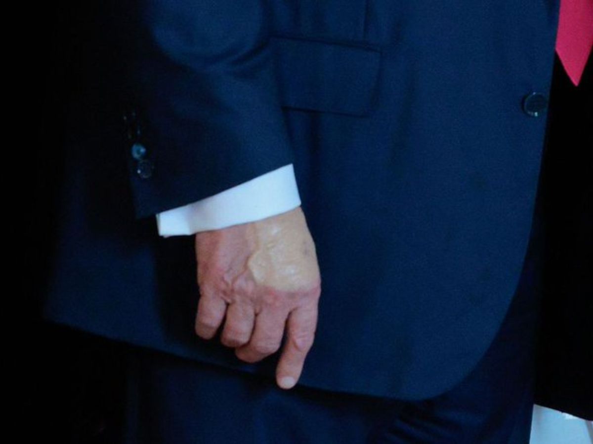 Trump applies concealer poorly - Photo Gallery