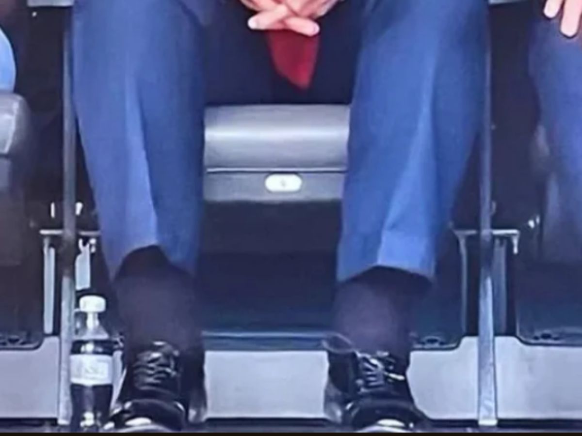 Trumps ankles are swollen - Photo Gallery