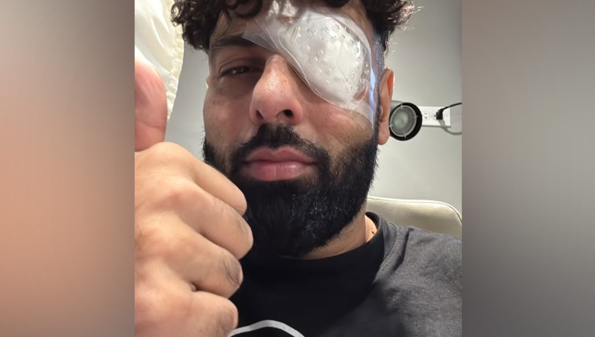 Singer Badshah injures his left eye during final show of the North America music tour
