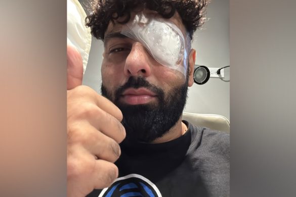 Singer Badshah injures his left eye during final show of the North America music tour