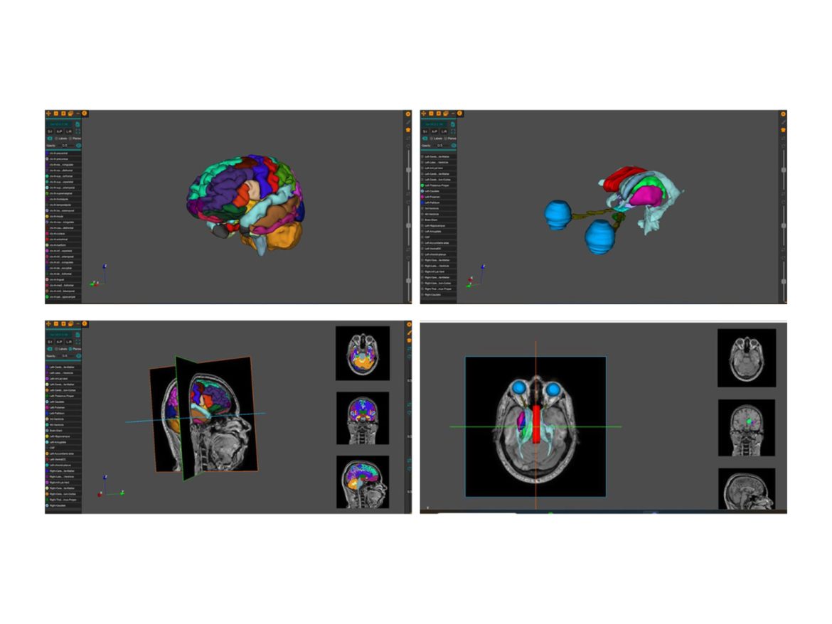 AnaVu: IIIT-Hyderabad's 3D Anatomy Visualization Platform Transforming Medical Education