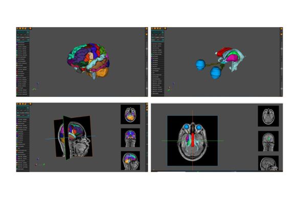 AnaVu: IIIT-Hyderabad's 3D Anatomy Visualization Platform Transforming Medical Education