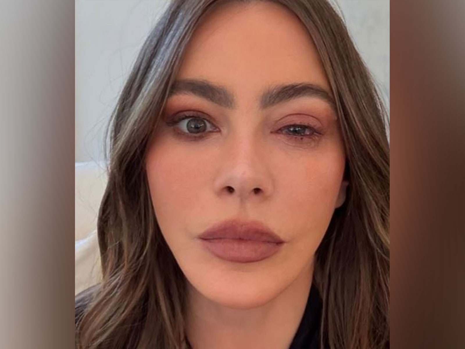 Sofia Vergara misses Emmys due to eye allergy